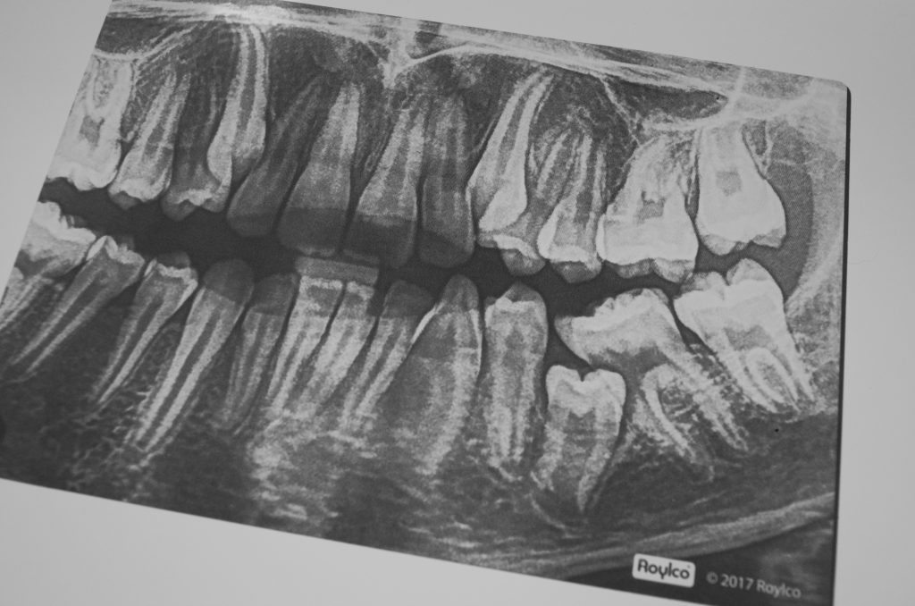 Dental X-Rays for Kids Learning Activity