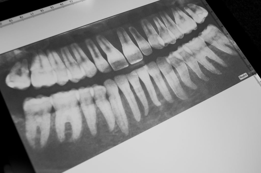 Dental X-Rays for Kids Learning Activity