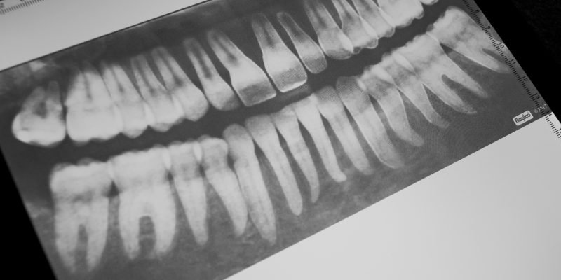 Dental X-Rays for Kids Learning Activity