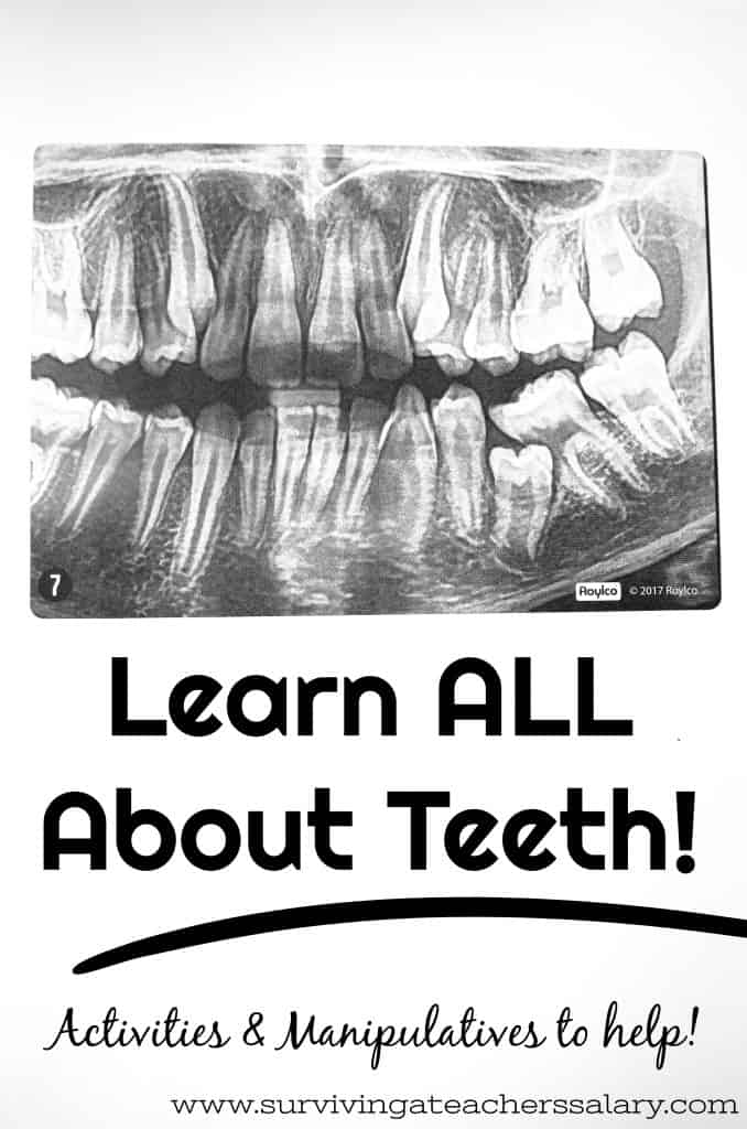 Learn All About Teeth - Dental X-Rays for Kids Learning Activity