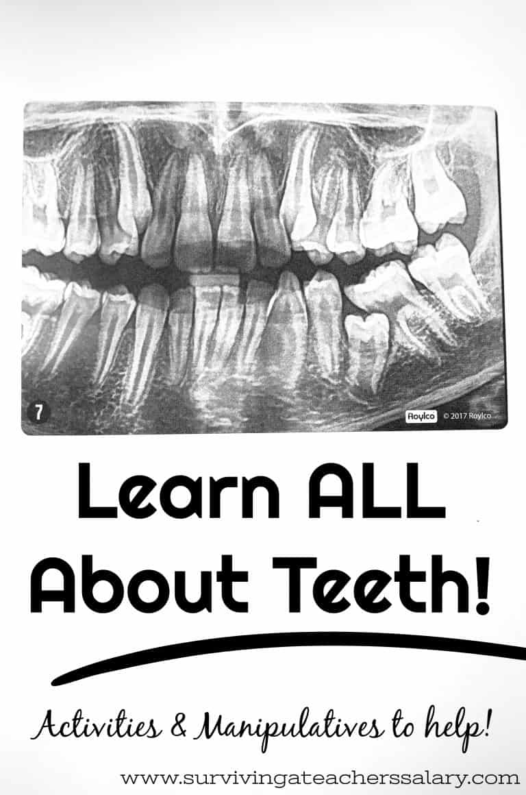 Learn All About Teeth with Dental XRays for Your Light Table