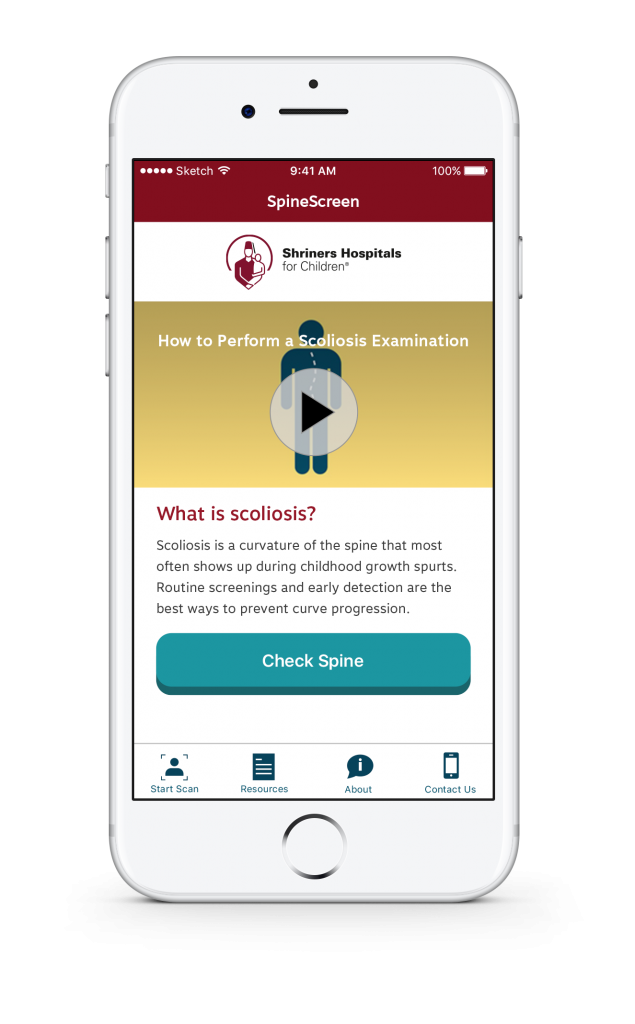 New Important SpineScreen App for Scoliosis Screening from Shriners Hospitals for Children